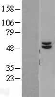 ATP5F1B Human Over-expression Lysate
