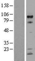 HIF1 beta (ARNT) Human Over-expression Lysate