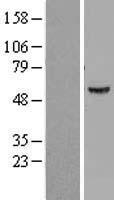 ATP6V1B1 Human Over-expression Lysate