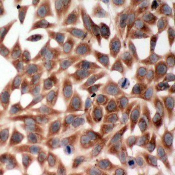 Anti-TRAF2 Antibody