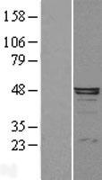 Alpha 1 microglobulin (AMBP) Human Over-expression Lysate