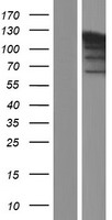 PARP1 Human Over-expression Lysate