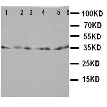 TRAM1 Antibody