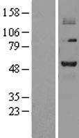 PRMT2 Human Over-expression Lysate