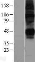 ENT2 (SLC29A2) Human Over-expression Lysate
