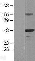 HDJ2 (DNAJA1) Human Over-expression Lysate