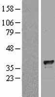 TFIIB (GTF2B) Human Over-expression Lysate