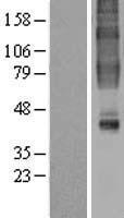 GPR32 Human Over-expression Lysate