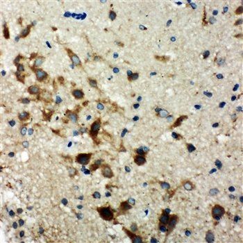 Anti-Hamartin/TSC1 Antibody