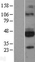 GFR alpha 3 (GFRA3) Human Over-expression Lysate