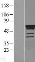 Estrogen Related Receptor gamma (ESRRG) Human Over-expression Lysate