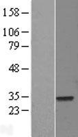 ELF5 Human Over-expression Lysate