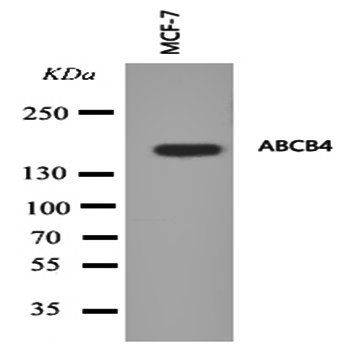 ABCB4 Antibody