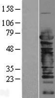 Cleavage stimulation factor 2 (CSTF2) Human Over-expression Lysate