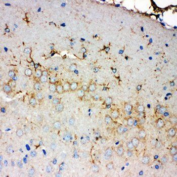 Anti-PMP70/ABCD3 Antibody