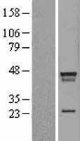 LDB2 Human Over-expression Lysate