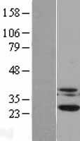 Casein Kinase 2 beta (CSNK2B) Human Over-expression Lysate