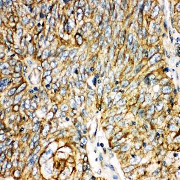 Anti-Aquaporin 6/AQP6 Antibody