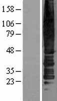 Chemokine Receptor D6 (ACKR2) Human Over-expression Lysate