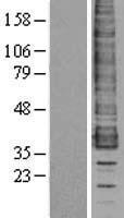 CCR1 Human Over-expression Lysate