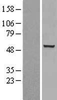 Chk1 (CHEK1) Human Over-expression Lysate