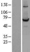 Liver Carboxylesterase 1 (CES1) Human Over-expression Lysate
