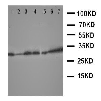 Aquaporin 9/AQP9 Antibody