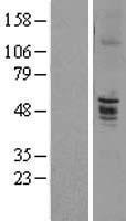 ENTPD6 Human Over-expression Lysate