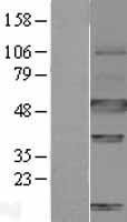 Carbonic Anhydrase IX (CA9) Human Over-expression Lysate