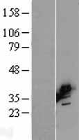 BCAT2 Human Over-expression Lysate