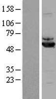 ALDH7A1 Human Over-expression Lysate