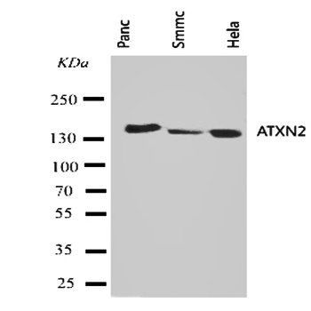 ATX2/ATXN2 Antibody