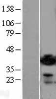 ADPRH Human Over-expression Lysate
