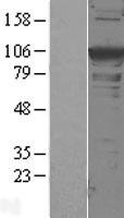 alpha Actinin (ACTN1) Human Over-expression Lysate
