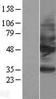 Somatostatin Receptor 2 (SSTR2) Human Over-expression Lysate