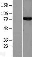 Transferrin (TF) Human Over-expression Lysate