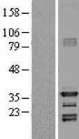 HEY1 Human Over-expression Lysate