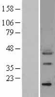 Osteopontin (SPP1) Human Over-expression Lysate
