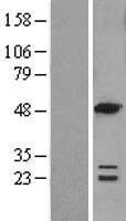 ACOT6 Human Over-expression Lysate