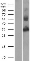 CHI3L2 Human Over-expression Lysate