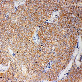 Anti-Caspase-12/CASP12 Antibody