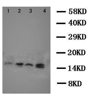 Stefin B/CSTB Antibody