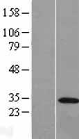 REEP3 Human Over-expression Lysate