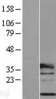 RPL29 Human Over-expression Lysate