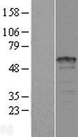 Retinoic Acid Receptor gamma (RARG) Human Over-expression Lysate