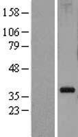 RPL5 Human Over-expression Lysate