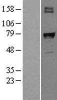 PTGS1 Human Over-expression Lysate