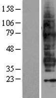 Prostaglandin F2 alpha Receptor (PTGFR) Human Over-expression Lysate