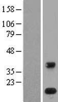 PLA2G1B Human Over-expression Lysate