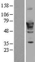 PDE1B Human Over-expression Lysate